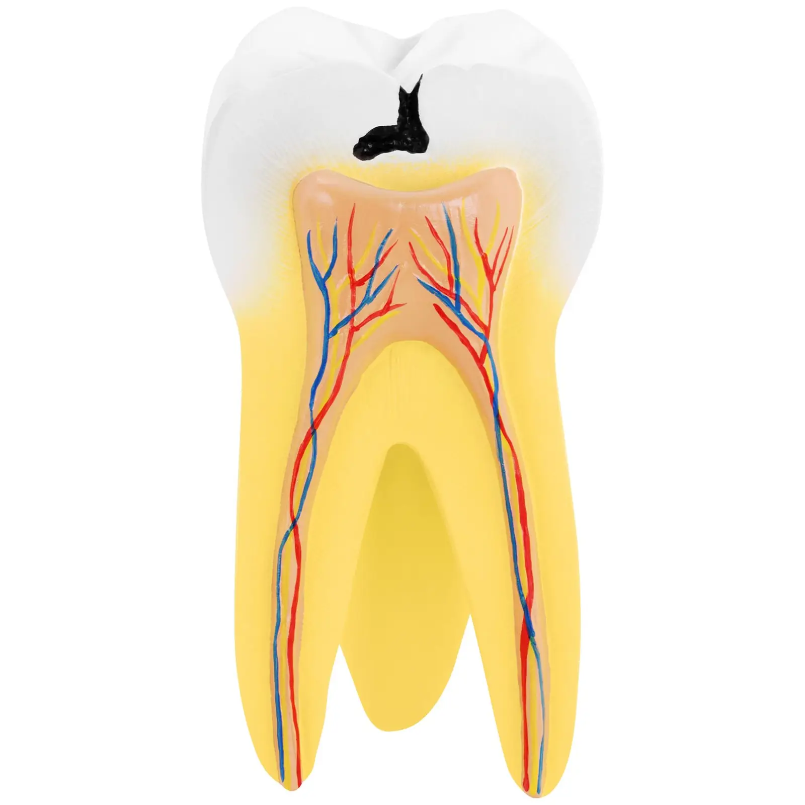 Zahnmodell - zweiwurzeliger Backenzahn - 2-teilig